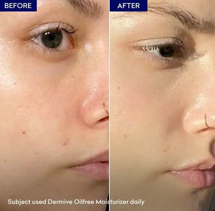 Jenpharm Dermive Oil Free