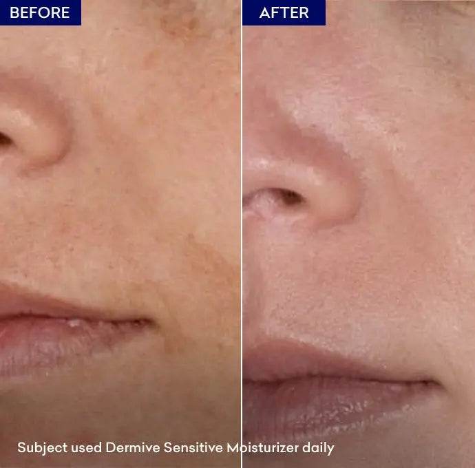 Jenpharm Dermive Sensitive Moisturizer
