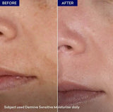 Jenpharm Dermive Sensitive Moisturizer