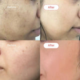 AccuFixCosmetics Kojic Acid + Glutathione Skin Brightening Cream