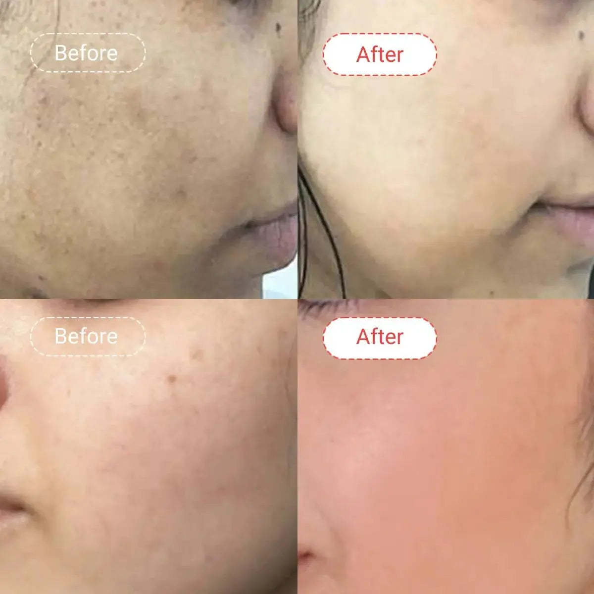 AccuFixCosmetics Kojic Acid + Glutathione Skin Brightening Cream