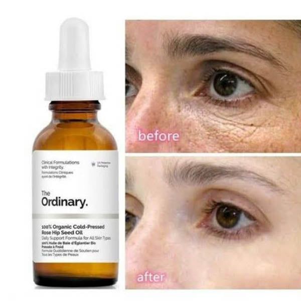 The Ordinary 100% Organic Cold-Pressed Rose Hip Seed Oil