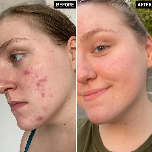 The Ordinary Glycolic Acid 7% Toning Solution