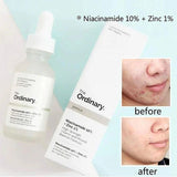 The Ordinary Niacinamide 10% + Zinc 1% 30ml